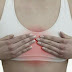 Try These Natural Treatments for Breast and Ovarian Cysts!